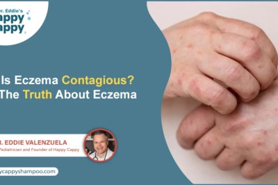Is Eczema Transmittable? Understanding the Facts About Eczema Contagion