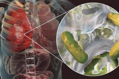 Lung Detox Spray Breathly: A Natural Solution for Cleaner Lungs