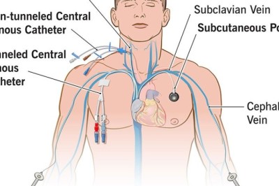 Parenteral Nutrition Market Market Penetration Across Low- and Middle-Income Nations