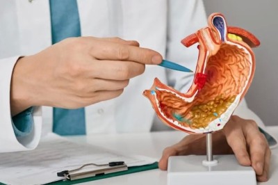 Understanding the Urea Breath Test in Dubai: A Complete Guide