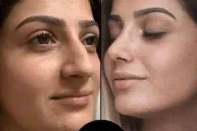 Best Aesthetic Clinic in Dubai Rated by Happy Clients