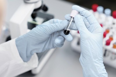 How Decentralized Clinical Trials Are Solving India's Rural Healthcare Access Problem?