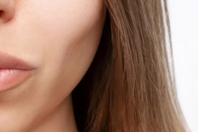 Sculptra Fillers in Dubai for Jawline and Cheek Enhancement