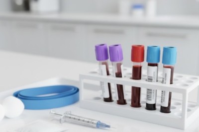 Kick-Start Your Healthcare Career with Our CPD-Certified Phlebotomy Course