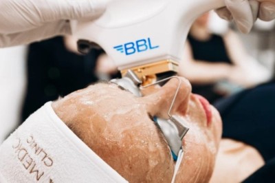 Why Choose BBL Laser in Manchester for Skin Rejuvenation?