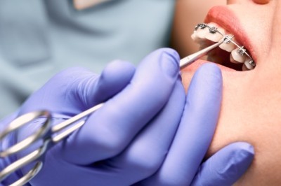 Invisalign Dubai: Clear Aligner Technology for Comfortable, Discreet Smile Alignment