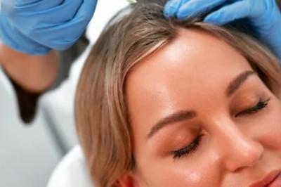 What Makes PRP Effective for Hair Regrowth in Islamabad?