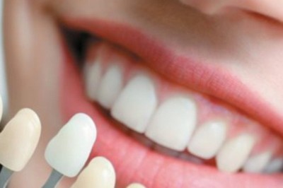 Hollywood Smile Makeover in Dubai: Achieve a Red-Carpet Worthy Smile