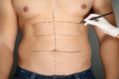 كيف تختار أفضل مركز لشفط الدهون في الرياض؟