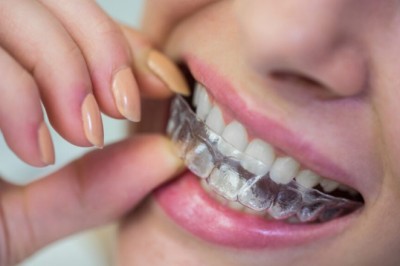 invisalign cost singapore