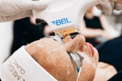 Skin Rejuvenation Made Easy BBL Laser in Manchester