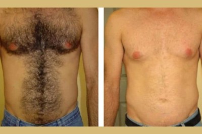 Best Plastic Surgeons in Dubai Using FDA-Approved Electrolysis & Laser Technologies
