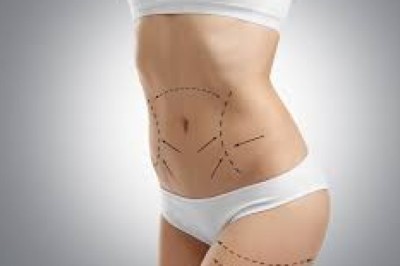 Mini Tummy Tuck Dubai: Cost and Consultation Guide