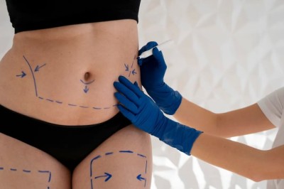 Mini Tummy Tuck Dubai: What It Is and Who Needs It