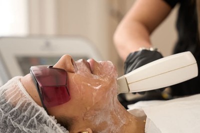 Fractional Laser Treatment in London – High-Performance Skin Resurfacing for Smooth, Refined and Youthful Skin