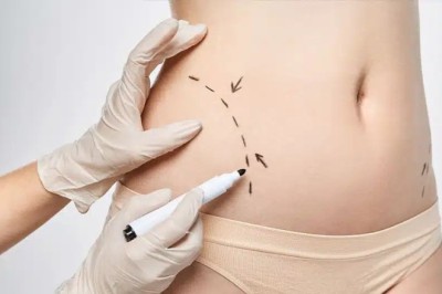 Body Contouring in Dubai: Before and After Results