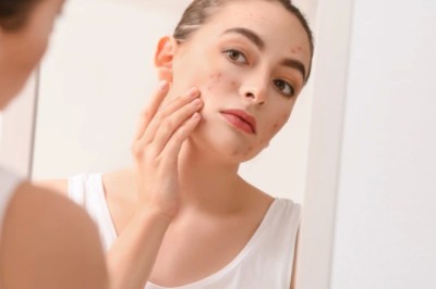 Why PRP Microneedling in Toronto is So Popular Right Now