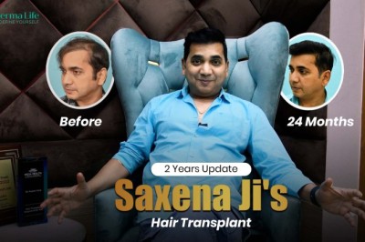 Top Celebrity Hair Transplant Doctor in Delhi, India: Evidence-Based Hair Restoration for Public Figures
