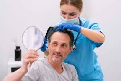 What Advanced Techniques Are Used in Beverly Hills Hair Transplant Procedures?
