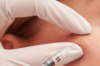 Safety Guidelines for Under Eye Fillers in Dubai