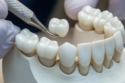 Cavities and Cracked Teeth? Get Professional Tooth Filling in Diamond Bar