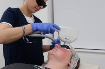 Fractional Laser Treatment In London: Advanced Laser Skin Resurfacing for Younger Looking and Smoother Skin