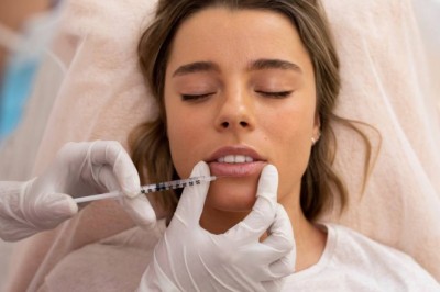 Natural Lip Injections for Soft, Balanced, and Naturally Fuller Lips