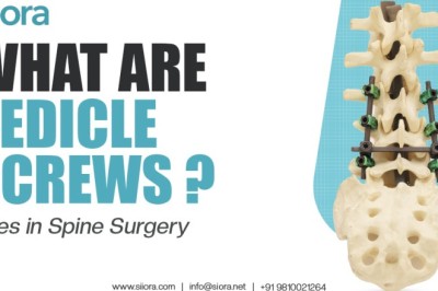 What Are Pedicle Screws? Uses in Spine Surgery
