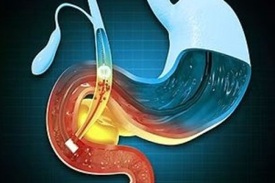 Recurring Upper Abdominal Pain? It Might Be Time to See a Gallbladder Specialist