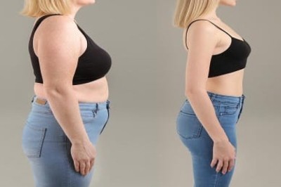 Weight Loss Clinics in Dubai: Before and After Transformations