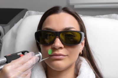 CO2 Laser in Manchester: Powerful Skin Resurfacing for Smooth Results