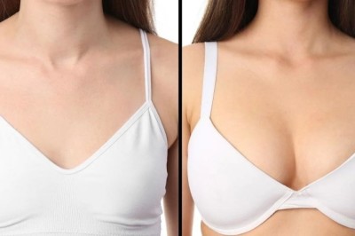 Latest Trends in Breast Augmentation in Dubai for Natural Results