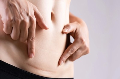 Why Do Clients Trust Scar Camouflage Dubai