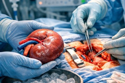 Kidney Stones Symptoms You Should Never Ignore | Urology Bangalore