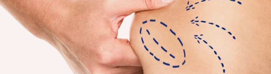 Liposuction Surgery