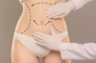Redefine Your Waistline: Tummy Tuck Surgery in Dubai with Dr. Hans