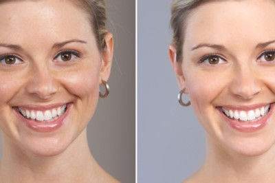 Skin Lightening Treatment in Delhi: Expert Solutions from Medlinks & Top Dermatologists in Gurgaon