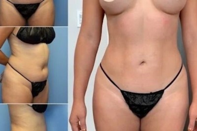 Discover Why the Best Body Contouring Surgeons in Dubai Are Right for You