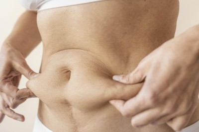 A 2025 Guide For Find The Best Liposuction Doctors in Dubai