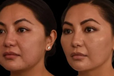 Innovations Forecasted by the Best Double Chin Removal Surgeon in Dubai