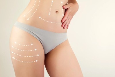Liposuction in Dubai Expert Tips for Informed Decisions