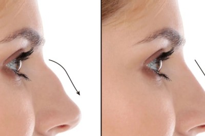 Surgical Precision That Heals: Nose Deviated Septum Surgery in Dubai