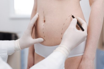 جراحة شفط الدهون في دبي: الحل المثالي لنحت الجسم وإعادة التناسق