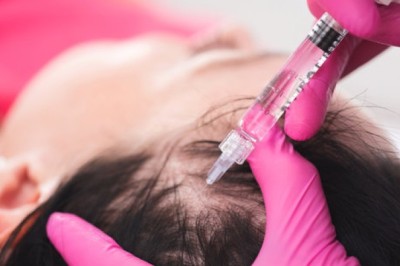 حقن البلازما للشعر: الحل الأمثل لاستعادة كثافة شعرك
