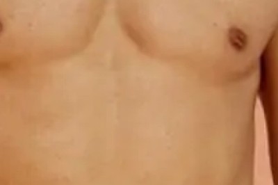 شفط الدهون في جدة كخطوة نحو جسم أكثر تناسقاً