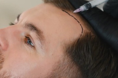 Hair Loss Treatment in Dubai: Innovative Non-Surgical and Clinical Options for Sustainable Hair Regrowth