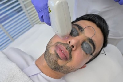 What Factors Affect Fractional CO2 Laser Treatment Cost in Dubai?