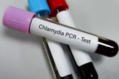 Chlamydia Test in Dubai for Married Couples
