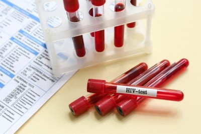 HIV Test in Dubai: Importance for Couples and Partners