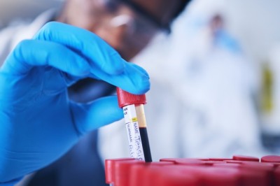 STD Screening Dubai: Understanding Confidentiality